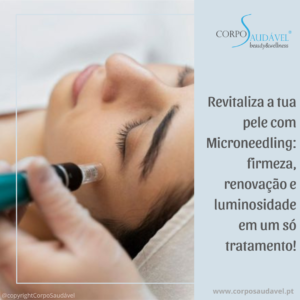 Revitaliza a tua pele com Microneedling: firmeza, renovação e luminosidade em um só tratamento